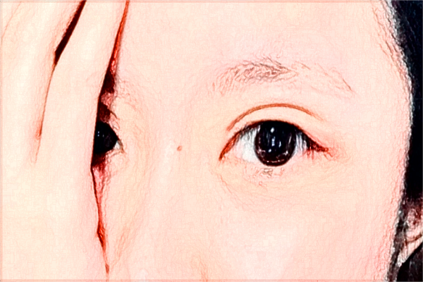 煙臺(tái)毓璜頂醫(yī)院熱瑪吉好嗎?2024熱瑪吉收費(fèi)價(jià)格