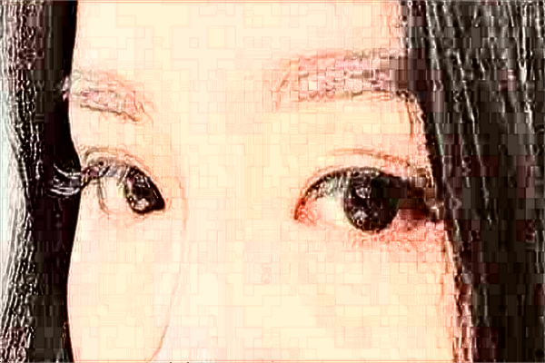 2024煙臺毓璜頂醫(yī)院飛秒激光價格?飛秒激光手術(shù)的利弊