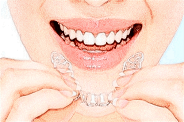 ??谑腥嗣襻t(yī)院牙齒矯正年齡范圍?牙齒矯正費(fèi)用