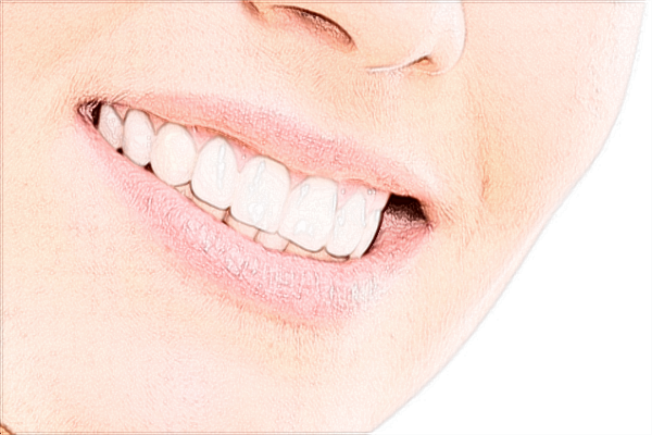 ??谑腥嗣襻t(yī)院牙齒矯正年齡范圍?牙齒矯正費(fèi)用