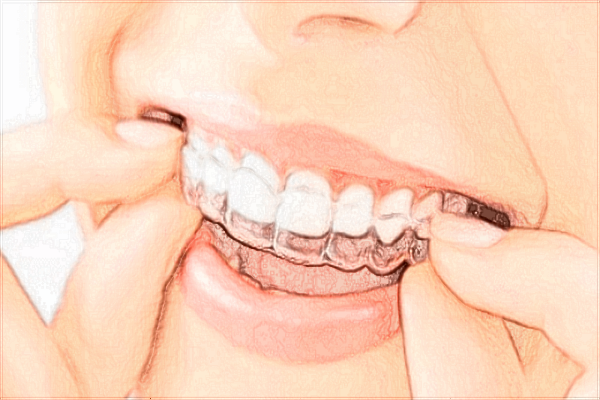 2024?？谑腥嗣襻t(yī)院牙齒矯正費(fèi)用?牙齒矯正醫(yī)生技術(shù)好嗎