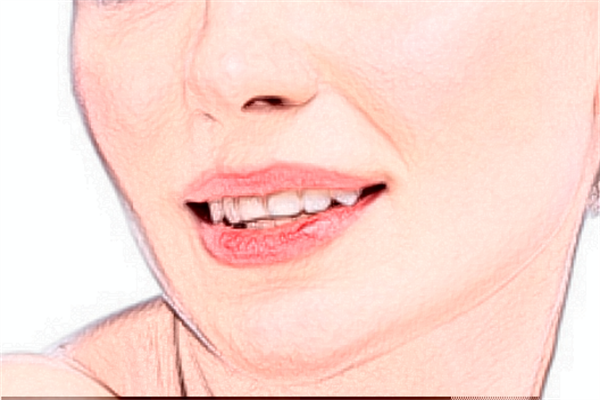 2024煙臺毓璜頂醫(yī)院祛痣費用?祛痣有哪些方法