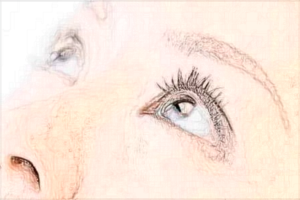 2024常德市第一人民醫(yī)院填淚溝多少錢(qián)?填淚溝幾天消腫