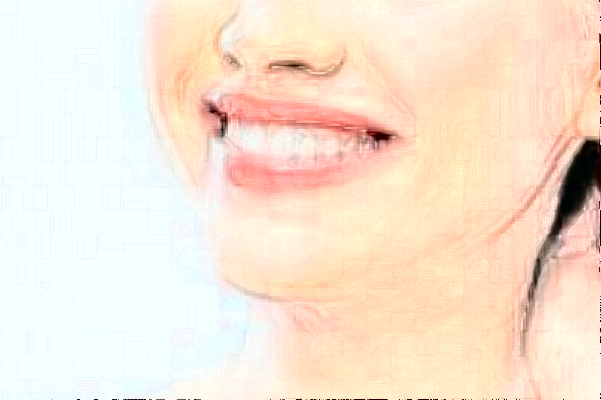 2024長沙好大夫口腔醫(yī)院鑲牙多少錢?做的怎么樣