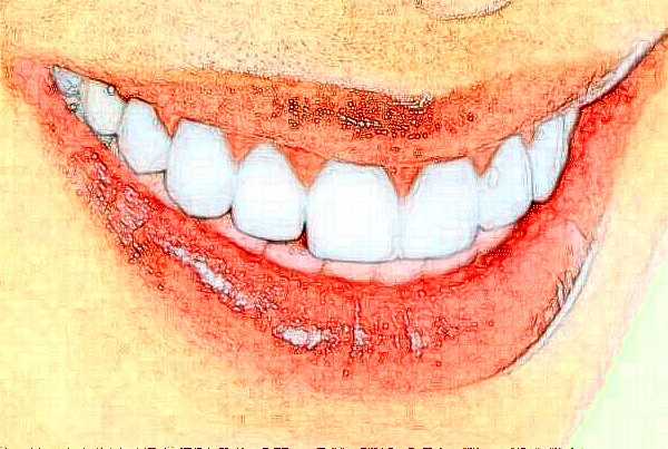 河北大學(xué)附屬醫(yī)院全瓷牙怎么樣_案例_價格