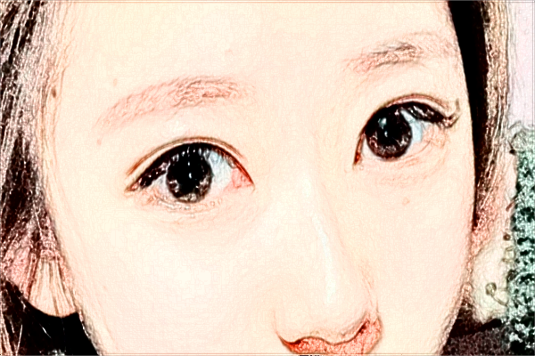 2024?？谑腥嗣襻t(yī)院飛秒手術(shù)價(jià)格?飛秒手術(shù)后注意事項(xiàng)