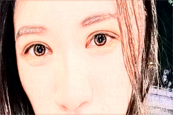 2024?？谑腥嗣襻t(yī)院飛秒手術(shù)價(jià)格?飛秒手術(shù)后注意事項(xiàng)