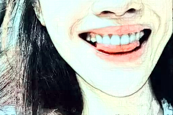 煙臺(tái)毓璜頂醫(yī)院種植牙咋么樣?種植牙的壽命多久