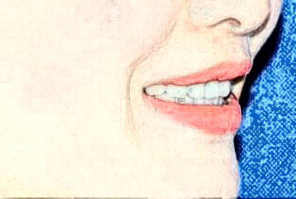 株洲市中心醫(yī)院補牙哪個醫(yī)生好些?2024全麻補牙費用