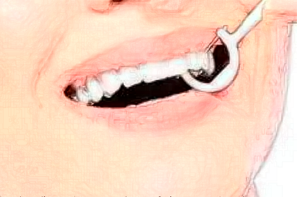 株洲市中心醫(yī)院拔牙醫(yī)生推薦?2024拔牙的收費價格