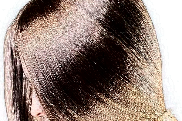 河北省人民醫(yī)院植發(fā)怎么樣_誰做得好