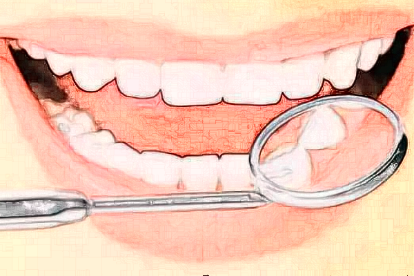 2024上海華美醫(yī)療美容醫(yī)院半口牙種植怎么樣_誰做得好
