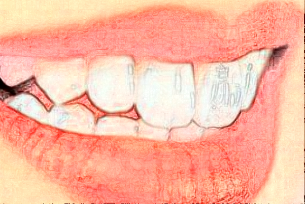 天津南開醫(yī)院拔智齒怎么樣_整形日記分享