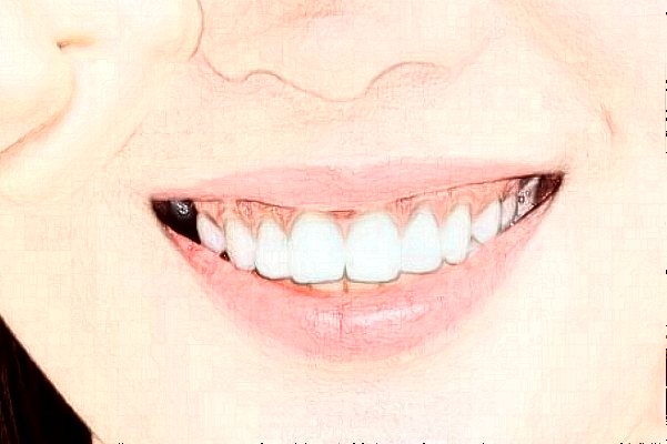 2024山西省人民醫(yī)院成人正畸價(jià)目表(價(jià)格表)_口碑怎么樣