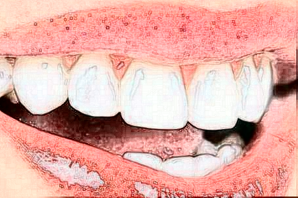 2024齊齊哈爾市中醫(yī)院牙齒種植怎么樣_醫(yī)生排名介紹