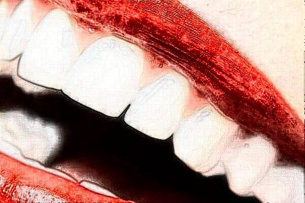 2024山西省人民醫(yī)院牙齒矯正費(fèi)用多少?整形日記全過(guò)程