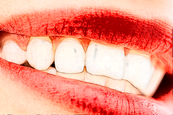 2024山西省人民醫(yī)院牙齒矯正費(fèi)用多少?整形日記全過(guò)程