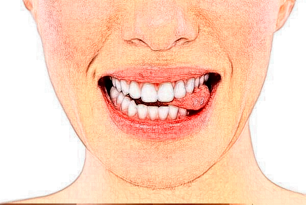 2024天津醫(yī)科大學(xué)總醫(yī)院口腔科冷光美白做的好嗎?整形日記分享