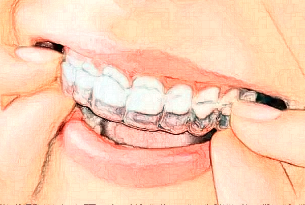 2024無錫市人民醫(yī)院烤瓷牙好嗎?附價(jià)格表+案例