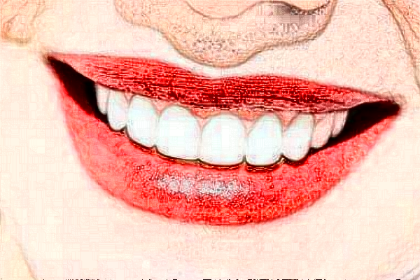 襄陽(yáng)新德恩口腔門(mén)診部正畸費(fèi)用多少_真實(shí)案例反饋