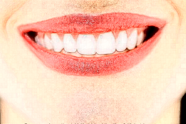 襄陽(yáng)新德恩口腔門(mén)診部正畸費(fèi)用多少_真實(shí)案例反饋