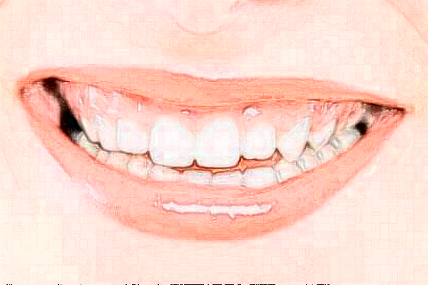 齊齊哈爾市中醫(yī)院牙齒畸形矯正怎么樣_醫(yī)生排名介紹