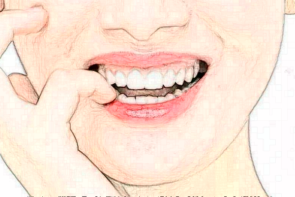 上海華美醫(yī)療美容醫(yī)院拔智齒好嗎_真實案例發(fā)布