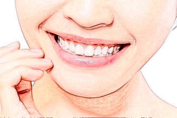 上海華美醫(yī)療美容醫(yī)院拔智齒好嗎_真實案例發(fā)布