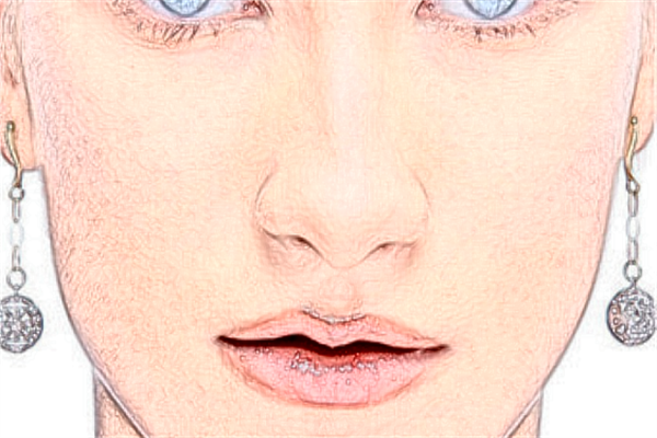 ?？谑腥嗣襻t(yī)院激光點(diǎn)痣好嗎?激光點(diǎn)痣會(huì)留疤嗎