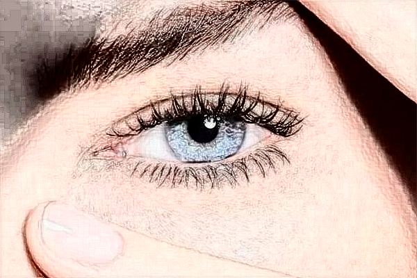 2024煙臺(tái)中醫(yī)院祛斑多少錢?激光祛斑怎么樣