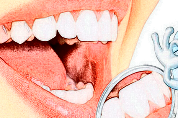 2024蘇北人民醫(yī)院烤瓷牙怎么樣?全新案例分享