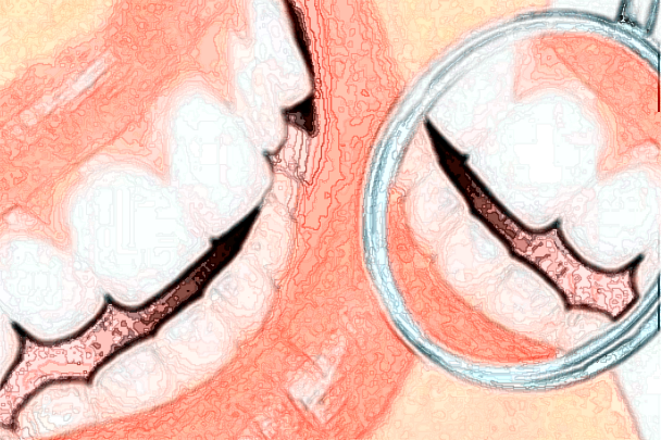 2024河北大學(xué)附屬醫(yī)院牙列不齊矯正怎么樣_整形日記分享