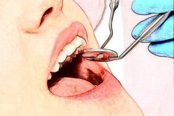 銅陵市人民醫(yī)院地包天矯正價位多少?專家介紹