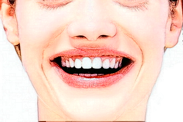 銅陵市人民醫(yī)院全瓷牙做的好嗎_醫(yī)生推薦