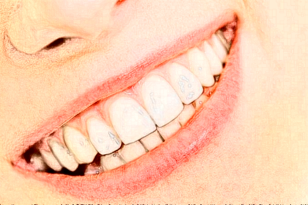 2024河北大學(xué)附屬醫(yī)院牙科醫(yī)生那個好_醫(yī)生排名