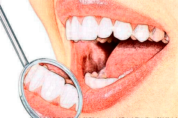 徐州醫(yī)科大學(xué)附屬醫(yī)院牙科怎么樣_醫(yī)生排名名單揭曉