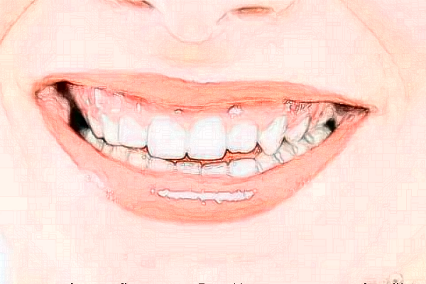 河北大學(xué)附屬醫(yī)院全口種植費用多少_醫(yī)生名單