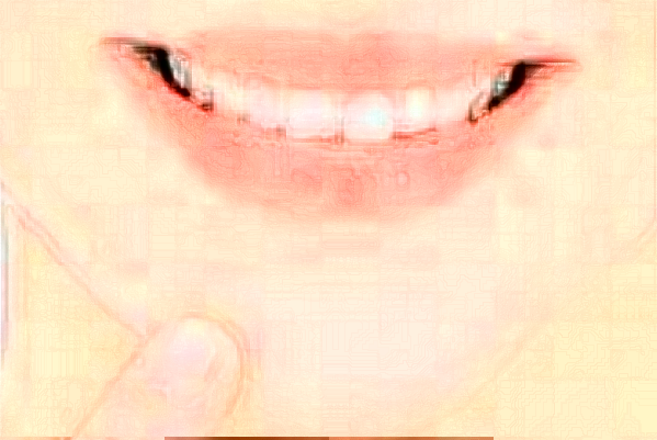 2024成都新橋口腔醫(yī)院拔智齒多少錢?拔智齒要多久恢復(fù)