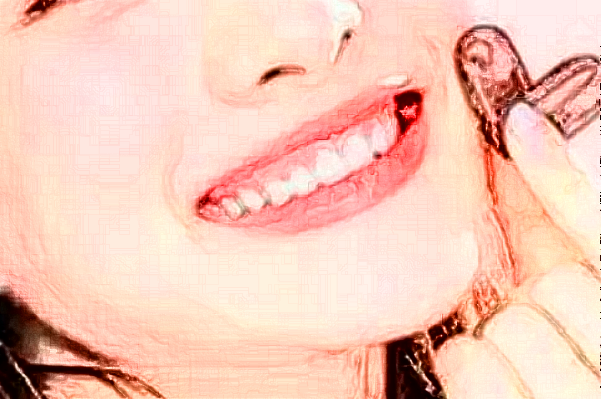 2024成都新橋口腔醫(yī)院牙齒矯正費用?牙齒矯正會改變臉型嗎?