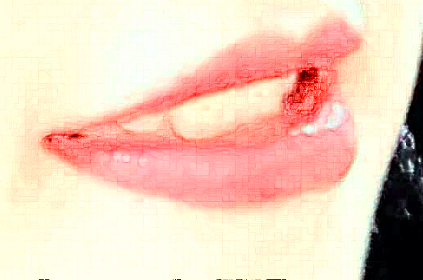 成都新橋口腔醫(yī)院好不好?口腔醫(yī)院有哪些項(xiàng)目