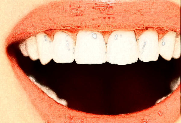 2024無錫市人民醫(yī)院補(bǔ)牙怎么樣【補(bǔ)牙案例】