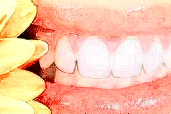 2024銅陵市人民醫(yī)院牙齒美白價位多少?專家介紹