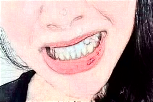 蘇州姑蘇美奧口腔瓷貼面怎么樣_誰做得好