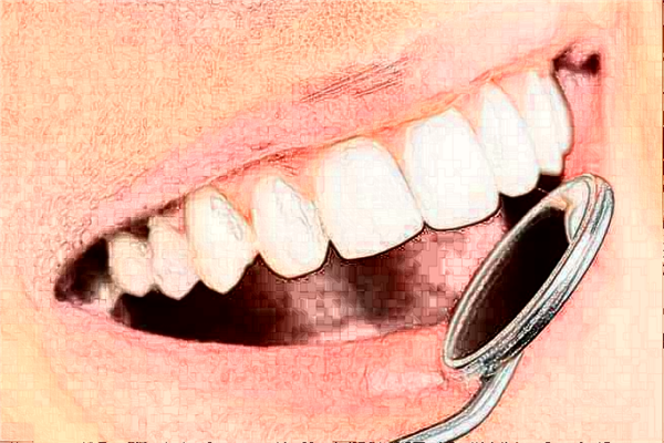 重慶齊美口腔門診部牙齒稀疏價(jià)目表全新發(fā)布!案例反饋