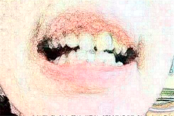 蘇州姑蘇美奧口腔是正規(guī)醫(yī)院嗎_地址_收費(fèi)標(biāo)準(zhǔn)