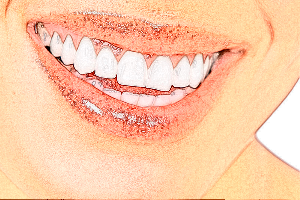 自貢華醫(yī)口腔醫(yī)院怎么樣?自貢華醫(yī)口腔醫(yī)院有哪些項(xiàng)目