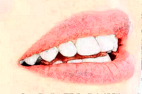 重慶維樂口腔醫(yī)院拔牙如何?拔牙要多久恢復(fù)