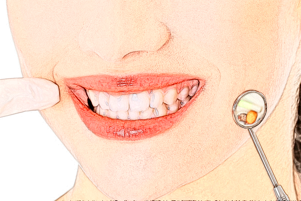 重慶世紀(jì)美奧口腔醫(yī)院洗牙好嗎?2024洗牙多少錢?