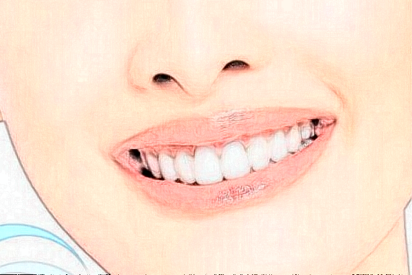 2024中山香山口腔醫(yī)院價格表?超聲波洗牙怎么樣