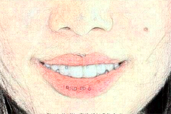 北京牙管家口腔診所補(bǔ)牙怎么樣|醫(yī)生介紹|價(jià)格收費(fèi)